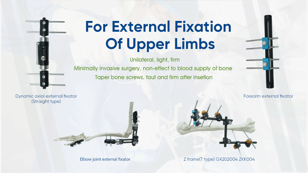 Upper Limb External Fixators - Buy Product on XC Medico Внешние фиксаторы верхних конечностей — покупка продукта на XC Medico