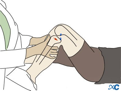 Knee Joint-14 Коленный сустав-14