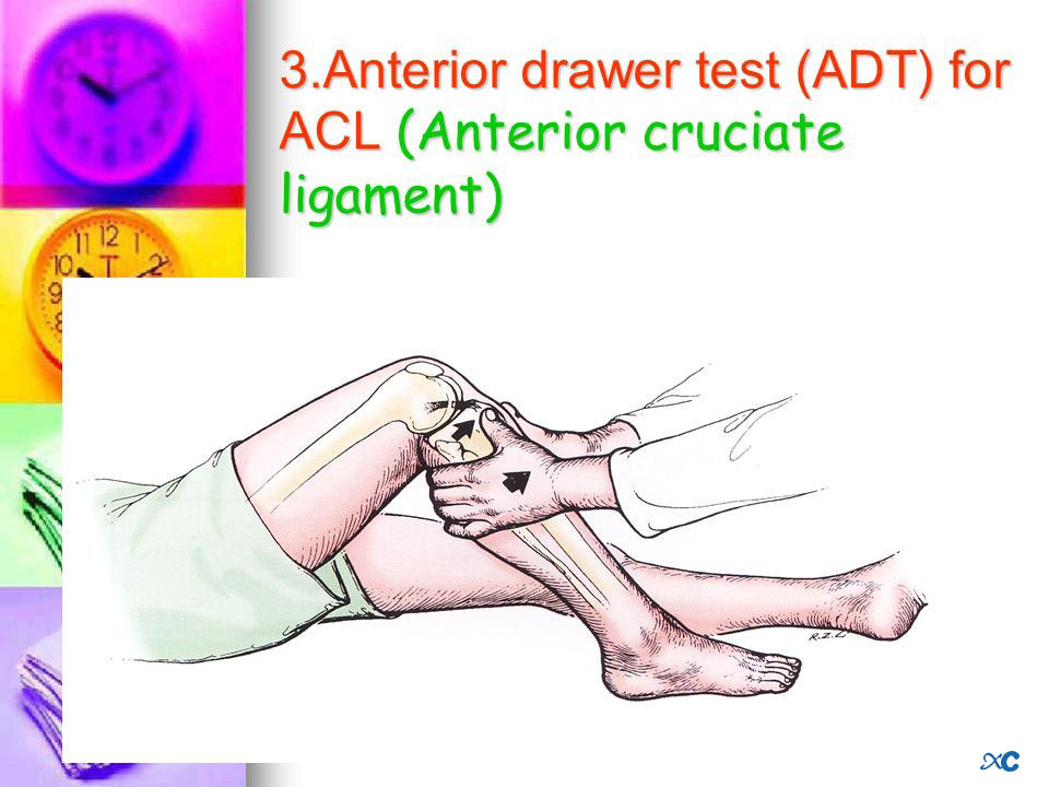 Knee Joint-13 Коленный сустав-13