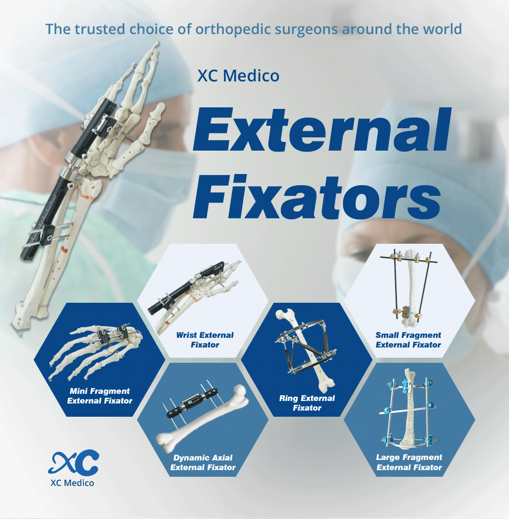 Wrist External Fixator - Buy Product on XC Medico Внешний фиксатор запястья — покупка продукта на XC Medico