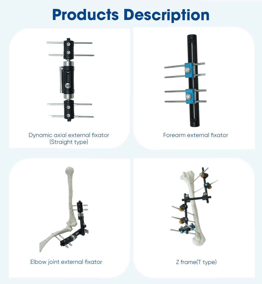 Upper Limb External Fixators - Buy Product on XC Medico Внешние фиксаторы верхних конечностей —