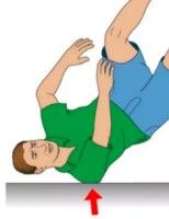 Diagnosis And Treatment Of Clavicle Fracture-6 Диагноз и лечение перелома ключицы-6