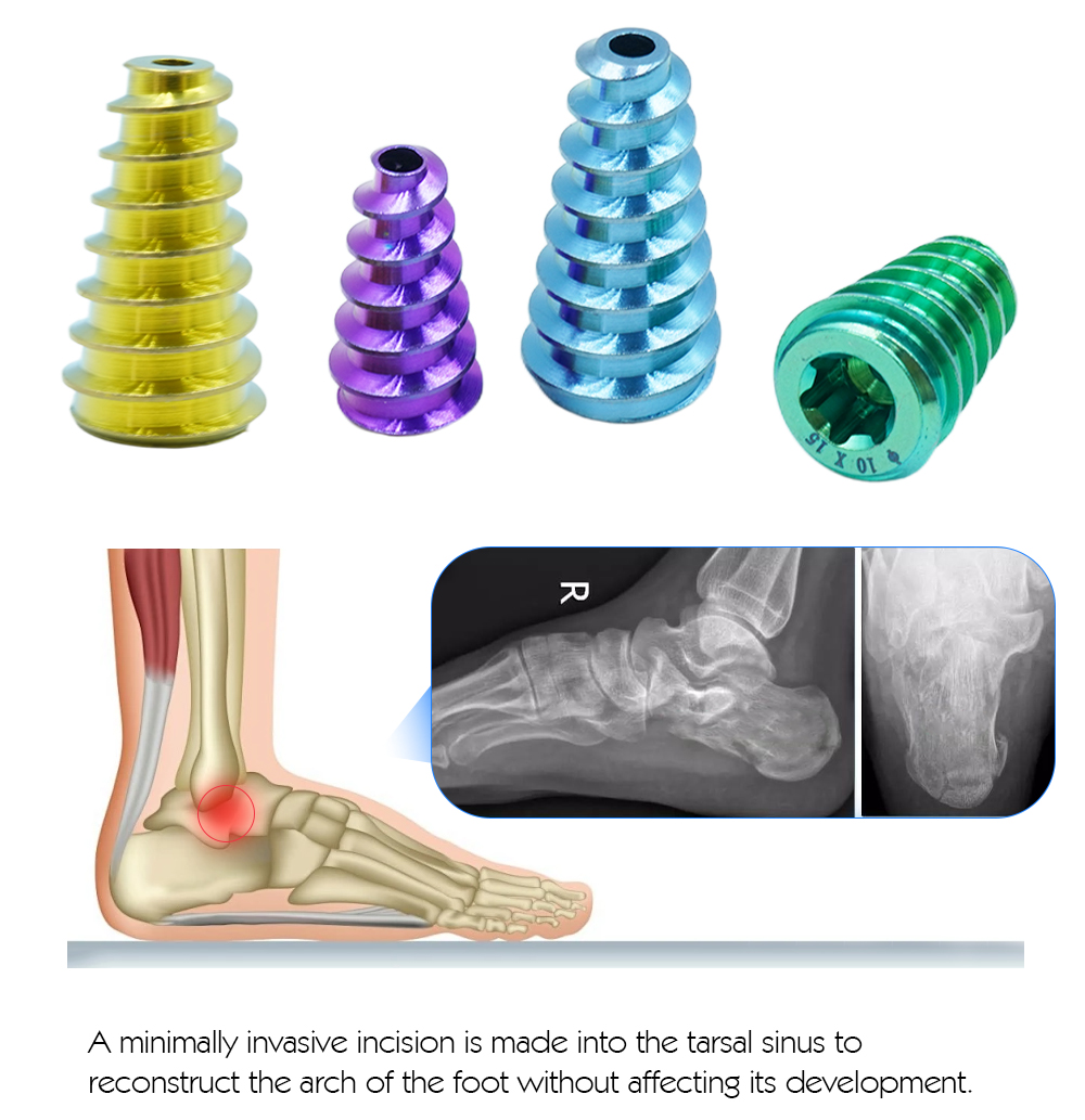 Набор инструментов для подтаранного винта (4)