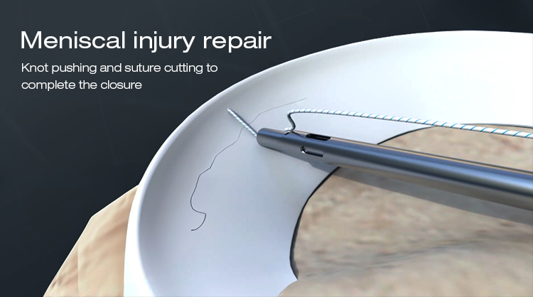 Disposable Knot Pusher and Suture Cutter | Arthroscopic Meniscal Repair Instrument Одноразовый толкатель узлов и резак для швов | Артроскопический инструмент для ремонта мениска