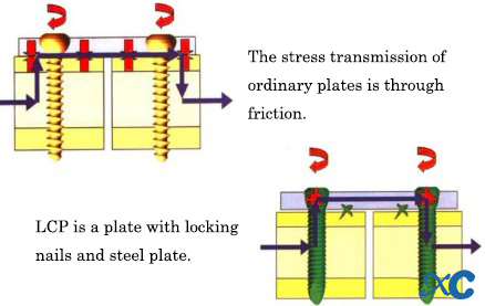 Proper Use Of The Locking Plate-3 Правильное использование стопорной пластины-3