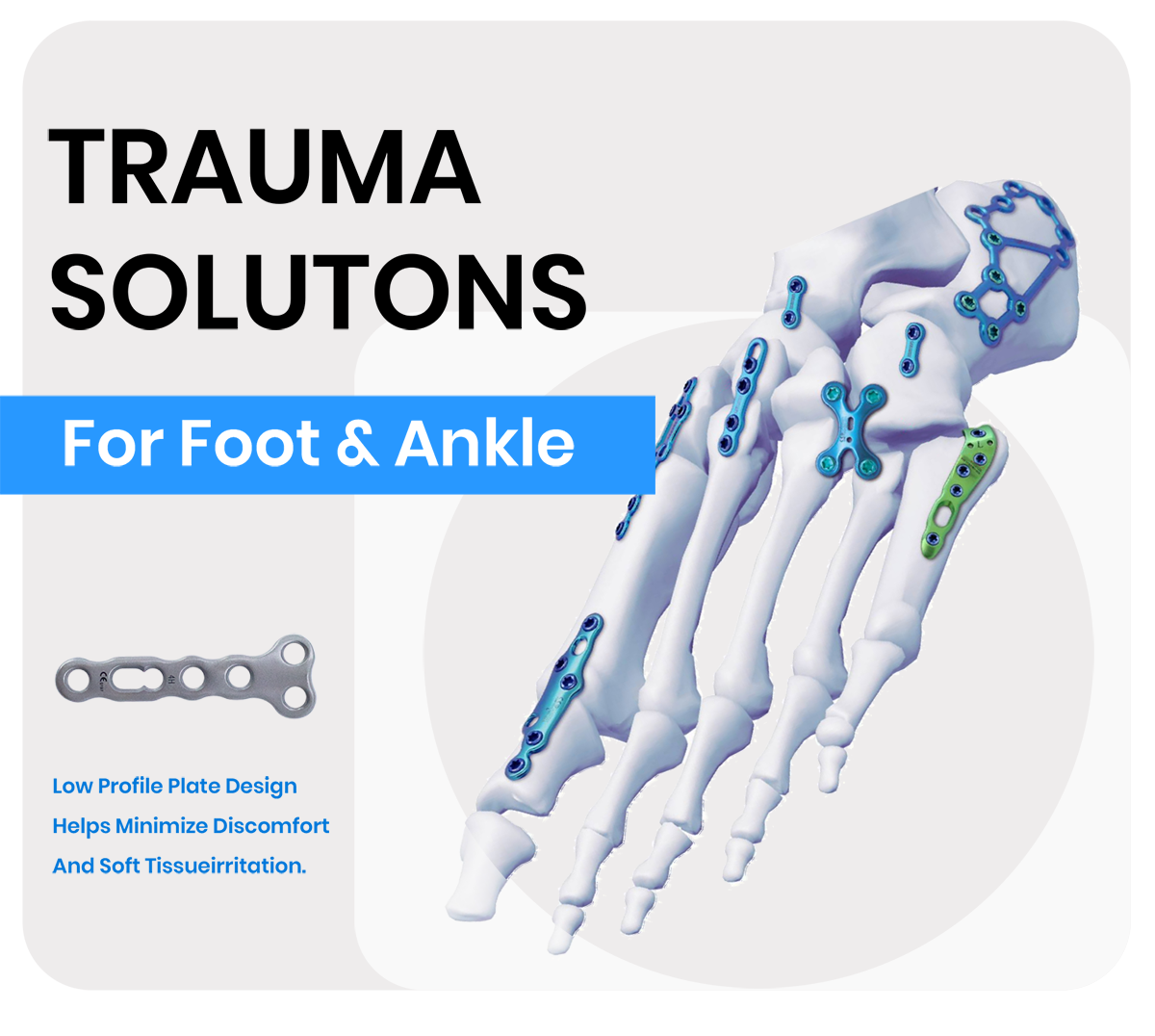 foot and ankle locking plate system (3) Система стопорных пластин для стопы и лодыжки (3)