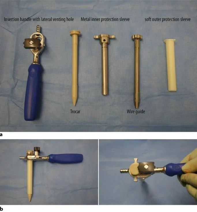 Tibial fractures, suprapatellar intramedullary nail technique-6 Переломы большеберцовой кости, супрапателлярная интрамедуллярная техника стержня-6