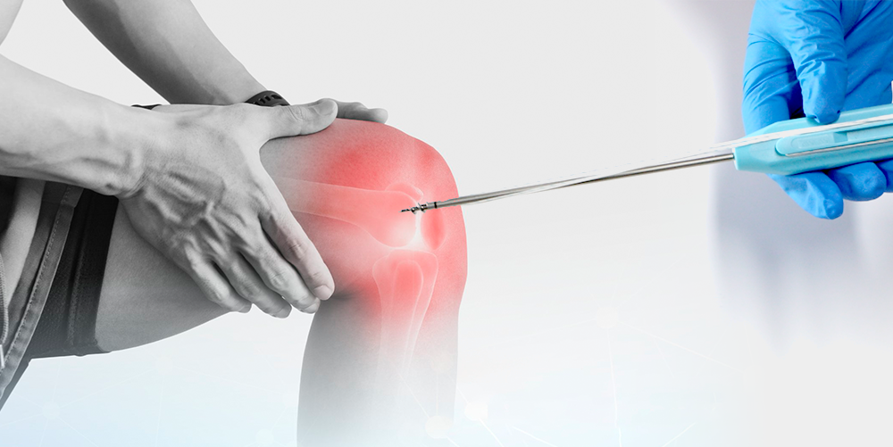 Titanium Suture Anchor | Ligament Repair Implant for Shoulder & Knee | XC Medico Титановый шовный анкер Имплантат для восстановления связок плеча и колена | XC Medico |