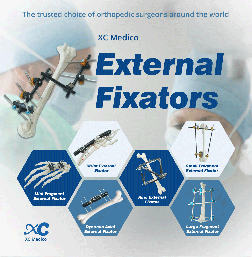 Upper Limb External Fixators - Buy Product on XC Medico Внешние фиксаторы верхних конечностей — покупка продукта на XC Medico