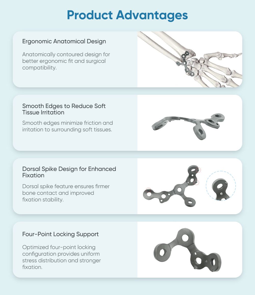 Locking Plate for Ulnar Styloid Process II - Buy Product on XC Medico Запирающая пластина для локтевого стилоидного процесса II — покупка продукта на XC Medico