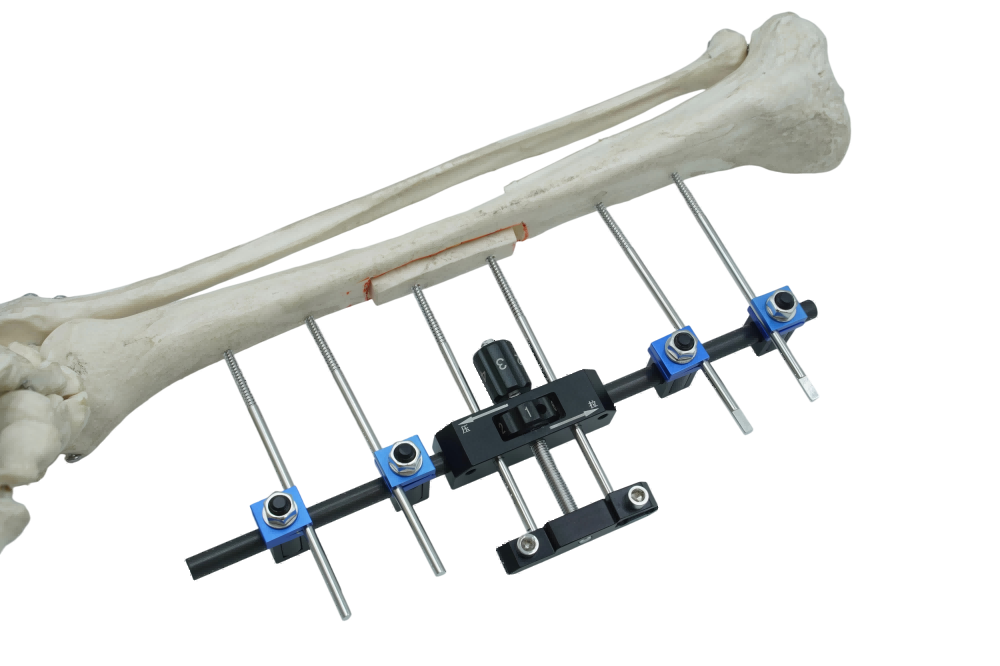 Recovery and Risks Восстановление и риски
