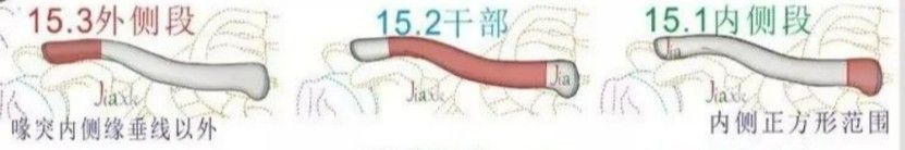 Diagnosis And Treatment Of Clavicle Fracture-11 Диагноз и лечение перелома ключицы-11