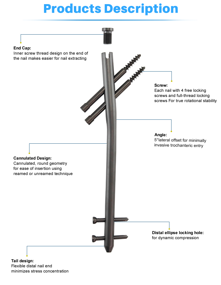 Titanium Gamma Nail | Proximal Femoral Fracture Fixation Implants - XC Medico - 2 титановый гамма-гвоздь | Имплантаты для фиксации проксимального перелома бедренной кости — XC Medico — 2