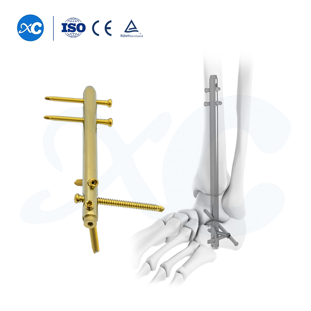 Гвоздь для лодыжки Fusion на задней стопе