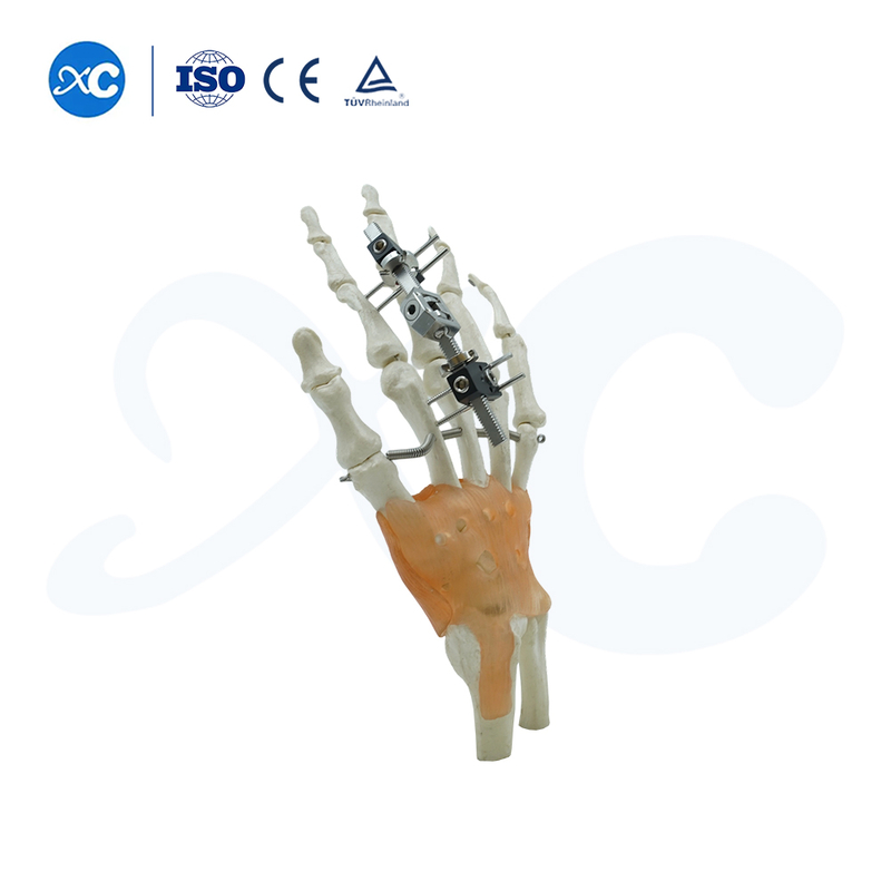 Тип движения мини-фиксатора сустава