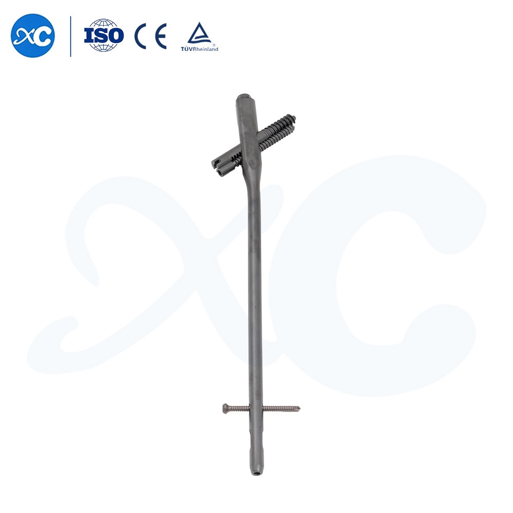 Система интрамедуллярных стержней Intertan – фиксация перелома проксимального отдела бедренной кости