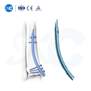 Дистальный большеберцовый интрамедуллярный стержень – ретроградная фиксация
