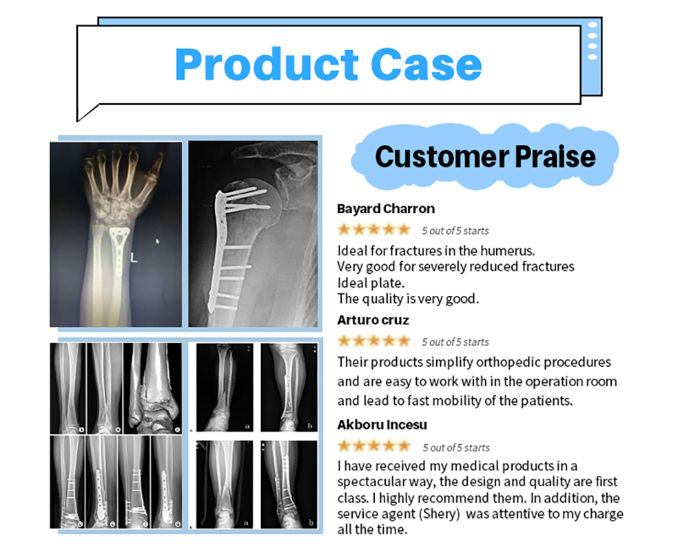 Набор инструментов для фиксации больших фрагментов - XC Medico