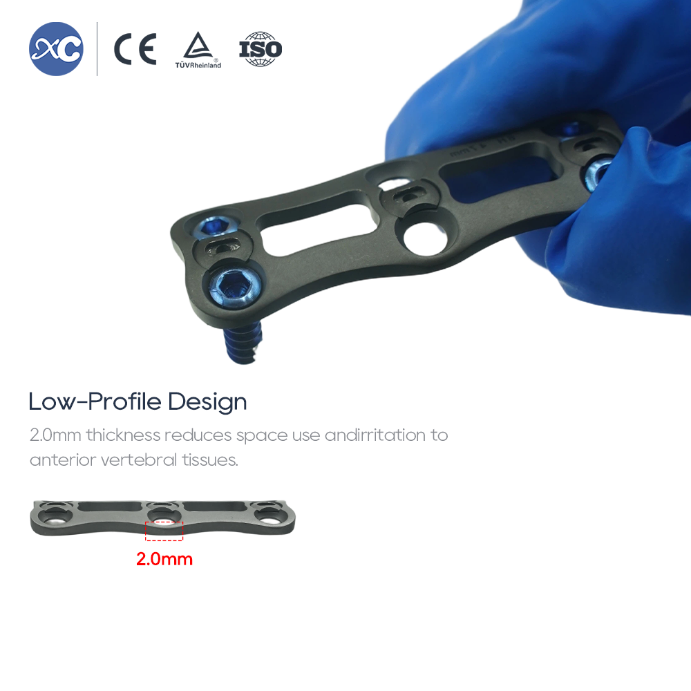 Система передних шейных пластин-I | Низкопрофильный титановый имплантат позвоночника