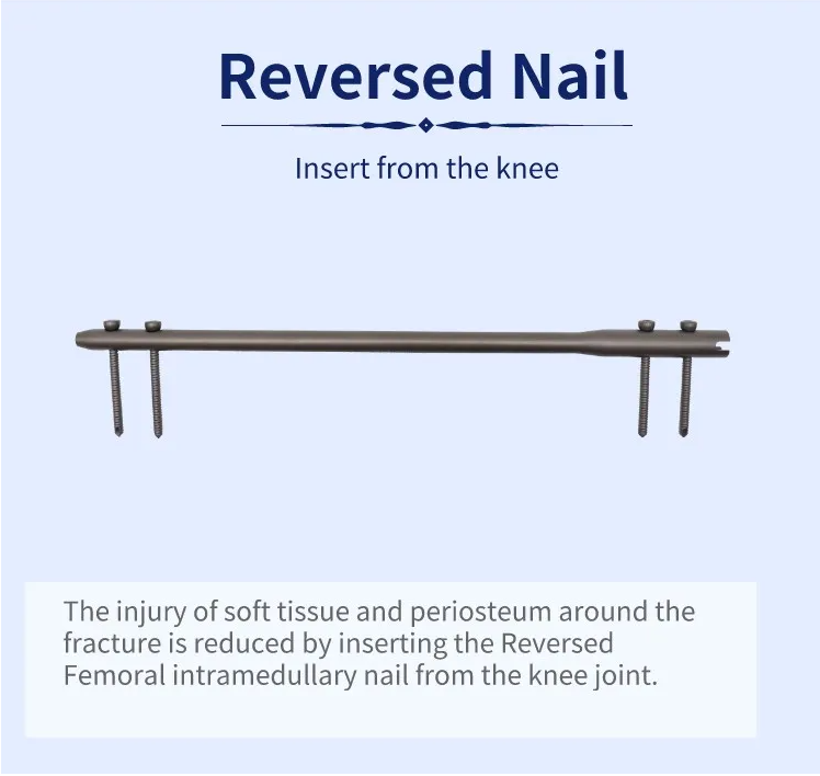 Реверсивный бедренный интрамедуллярный стержень-2