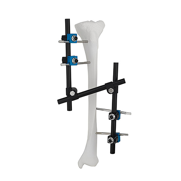 Внешний фиксатор больших фрагментов