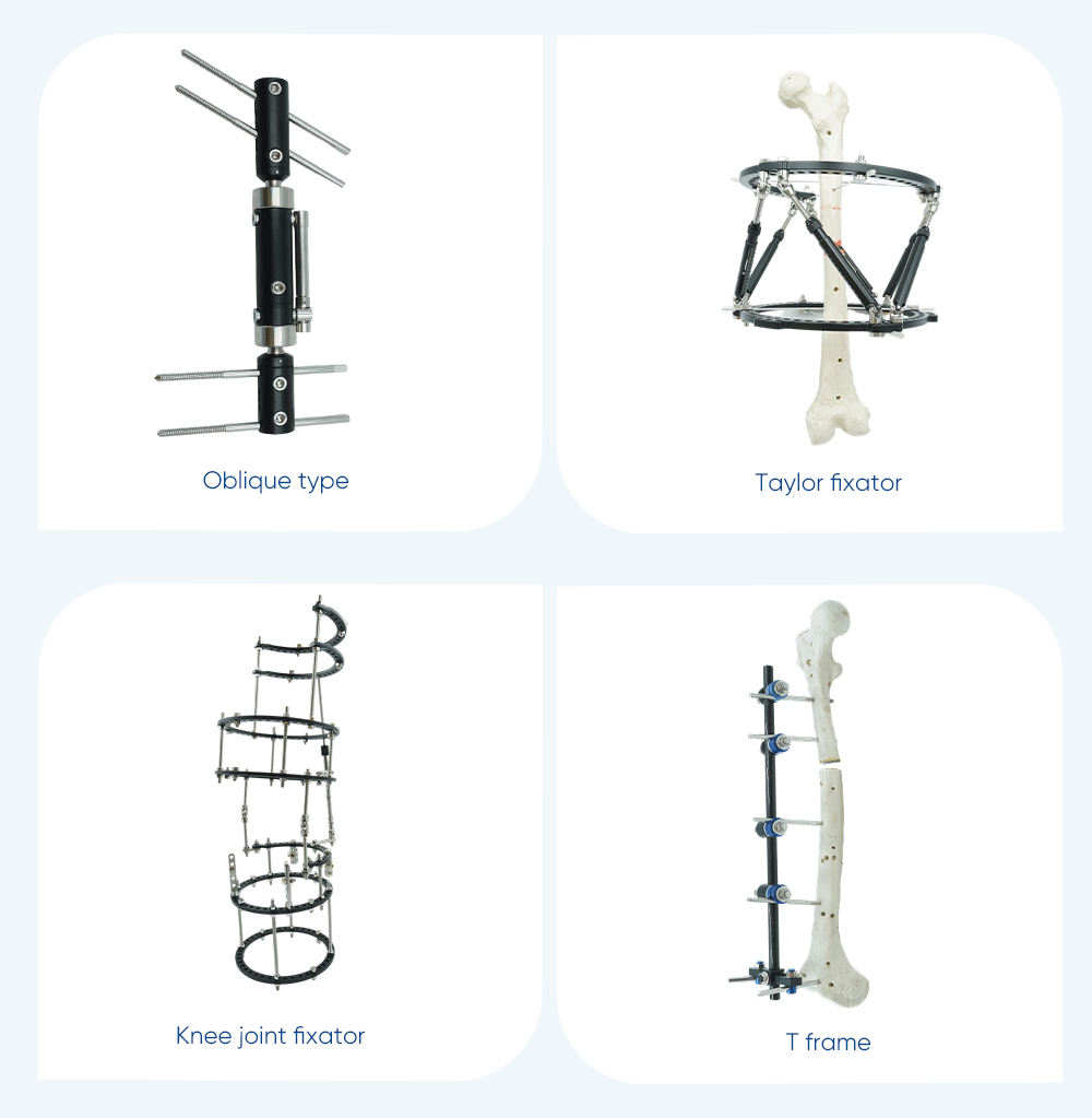  Внешний фиксатор для ноги — покупка продукта на XC Medico 