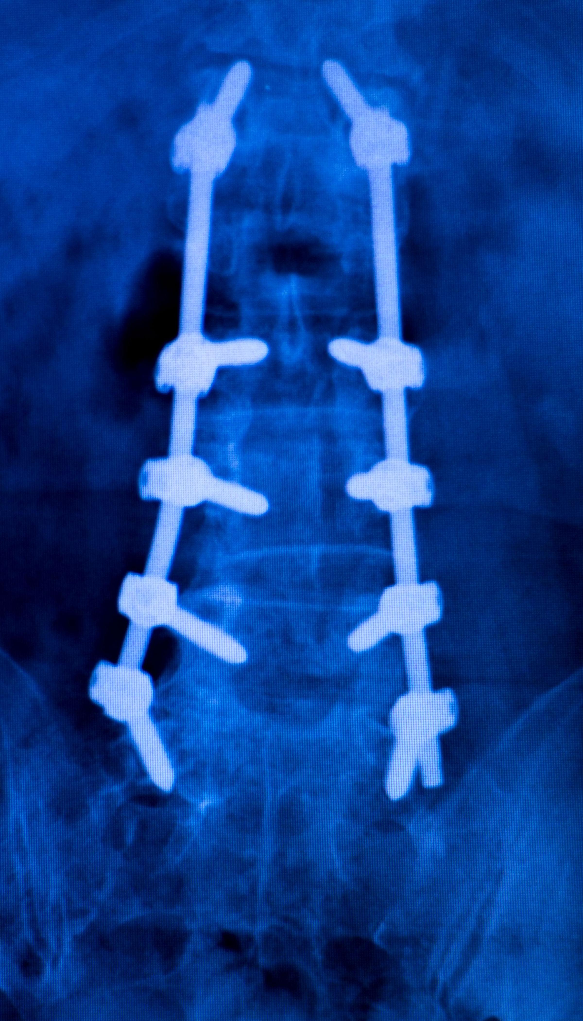 позвоночник баннер-2