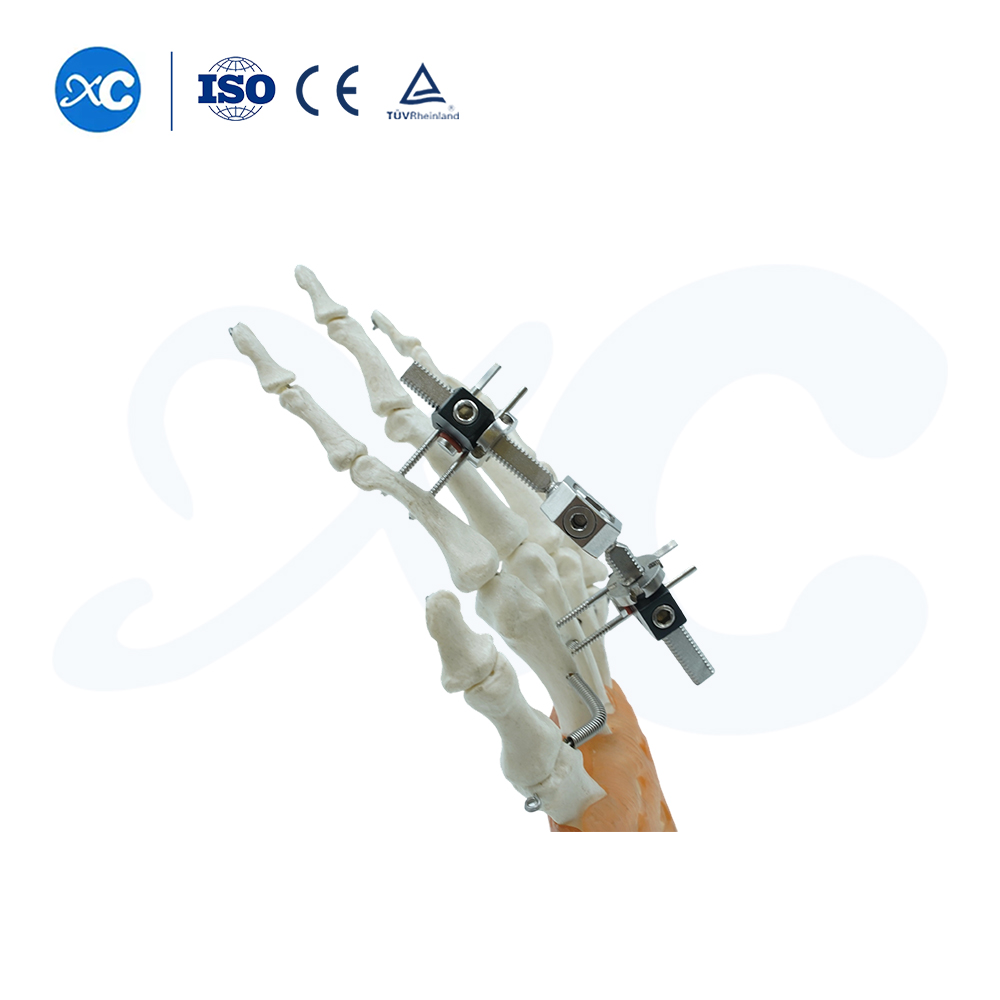 Тип движения мини-фиксатора сустава