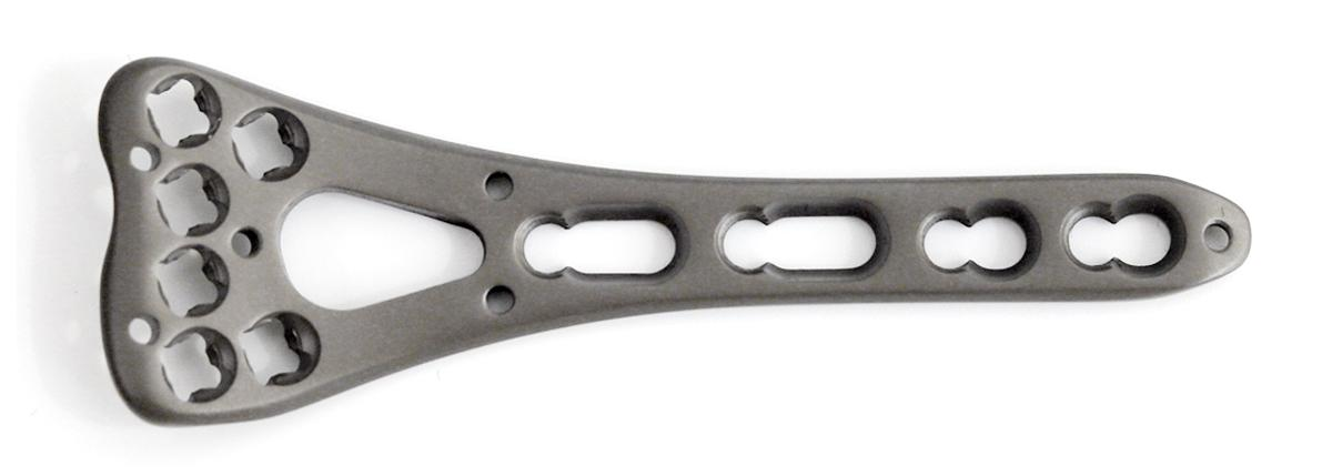 Фиксирующая пластина дистального радиуса (6 отверстий)