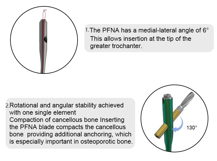 Описание интрамедуллярного гвоздя PFNA-3