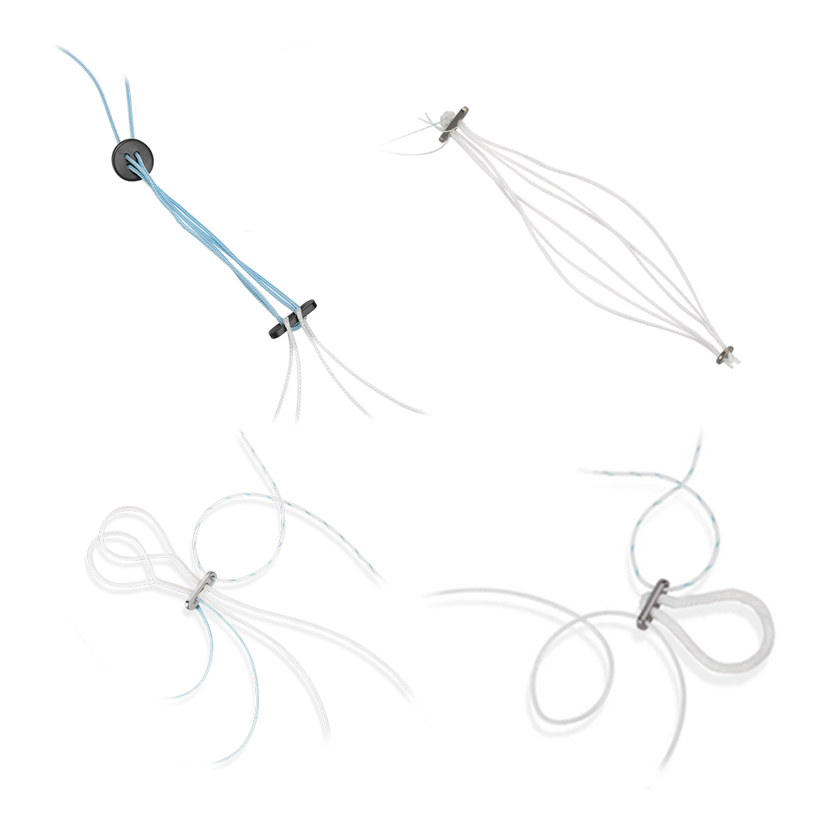 Система фиксации связок