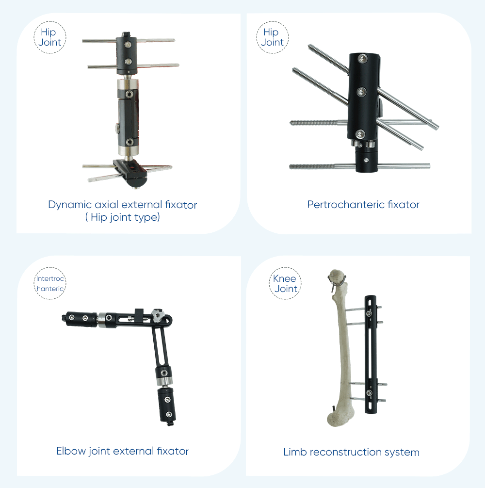  Внешний фиксатор для ноги — покупка продукта на XC Medico 
