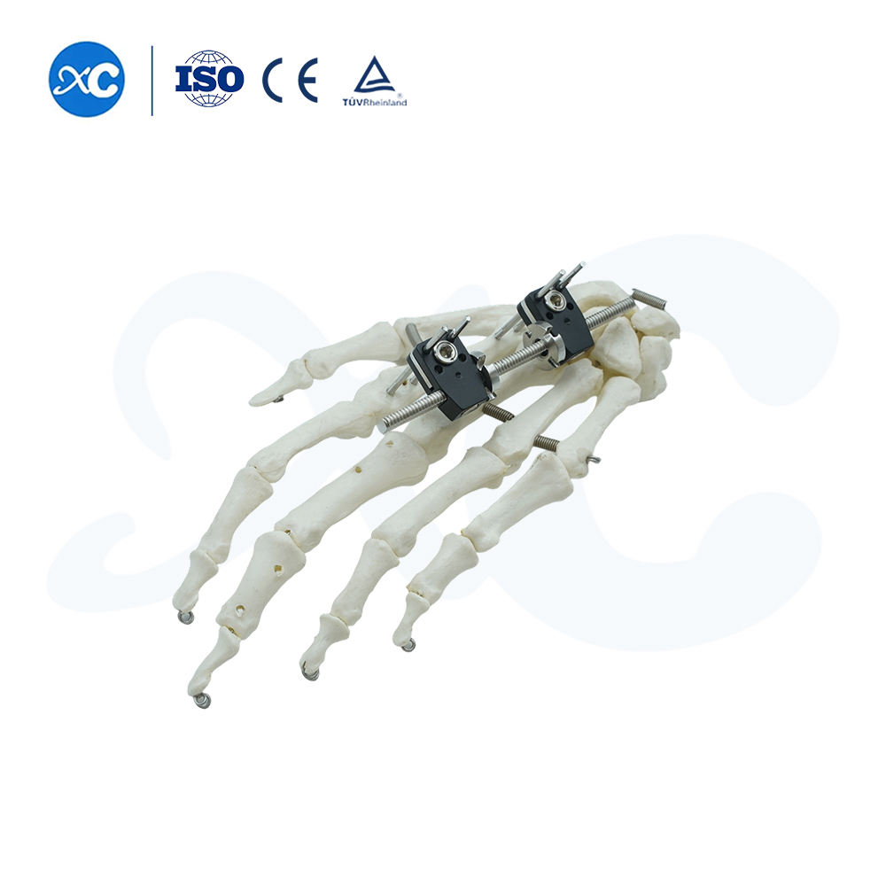 Мини-фиксатор прямого типа