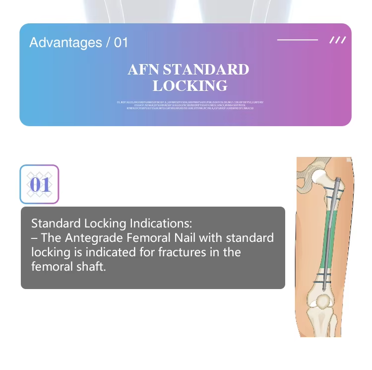 Реконструкция бедренной кости Интрамедуллярный стержень-2