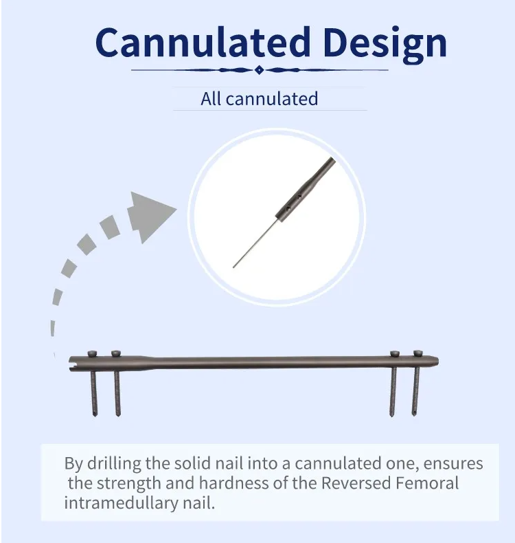 Реверсивный бедренный интрамедуллярный стержень-4