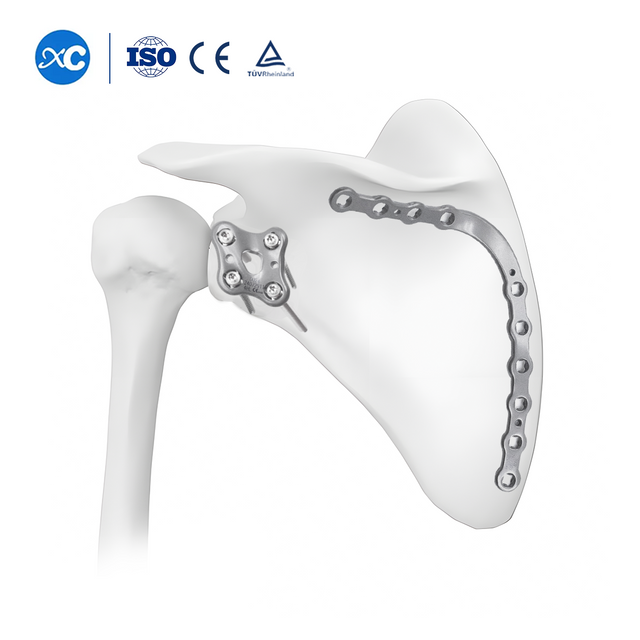 Запирающая пластина лопатки