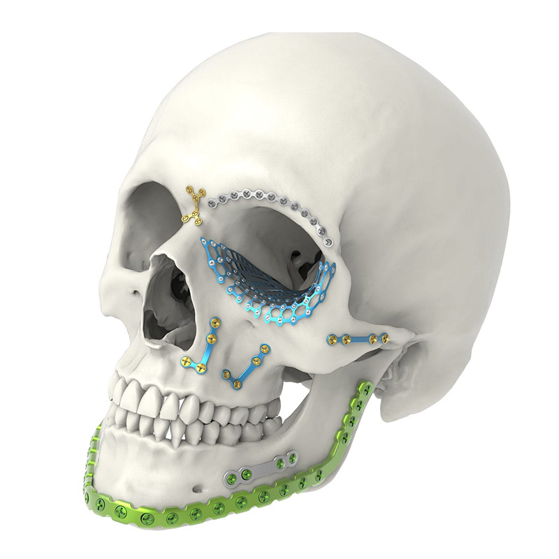 CMF челюстно-лицевой