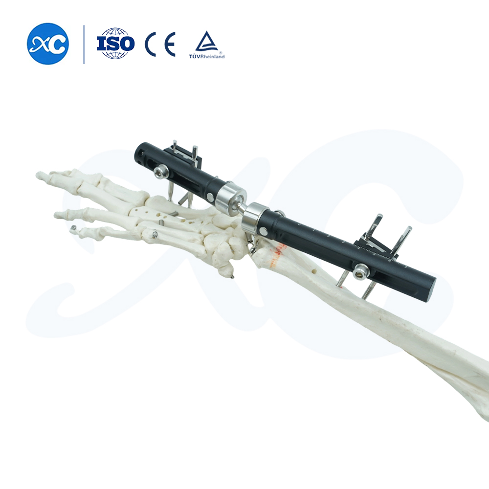 Внешний фиксатор запястья стандартного типа