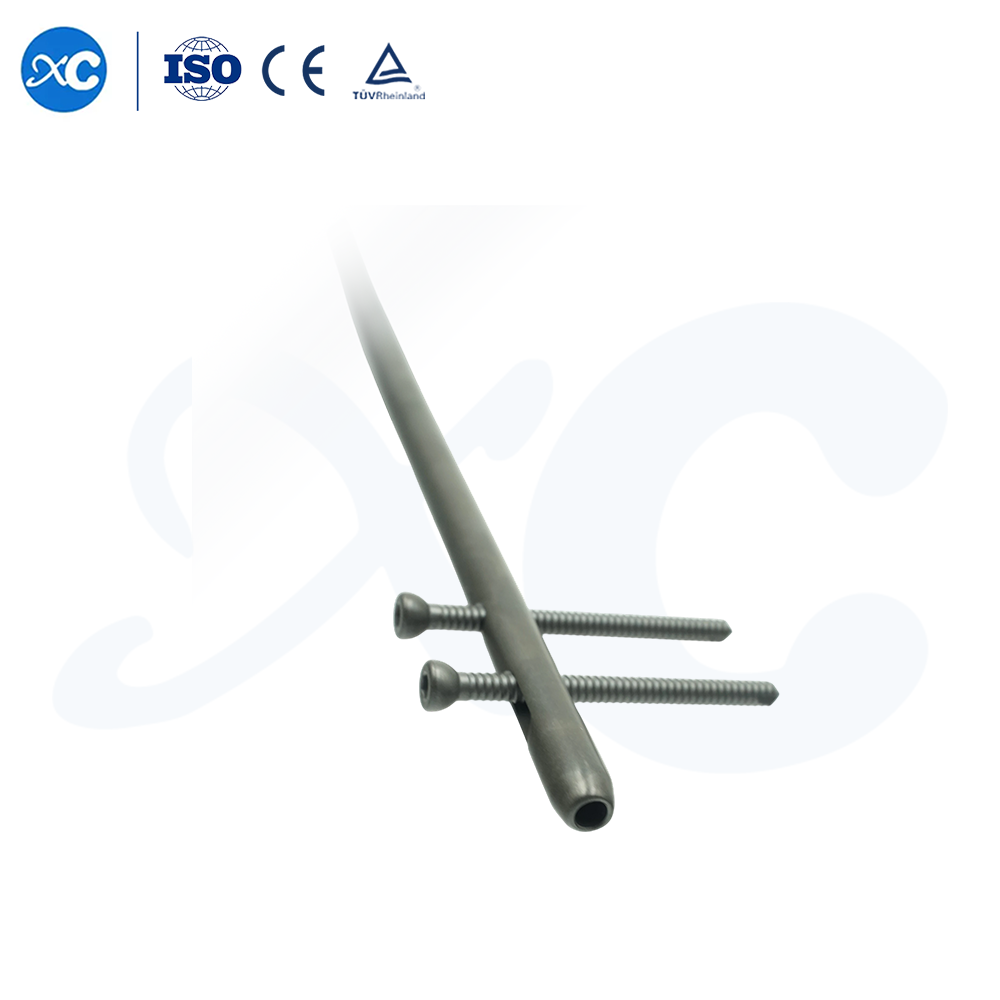 Система интрамедуллярных стержней Intertan – фиксация перелома проксимального отдела бедренной кости