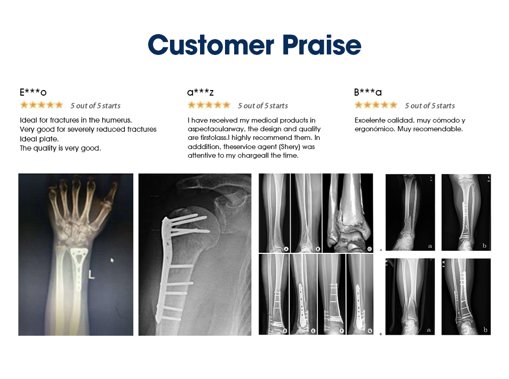 Набор инструментов для небольших фрагментов - XC Medico