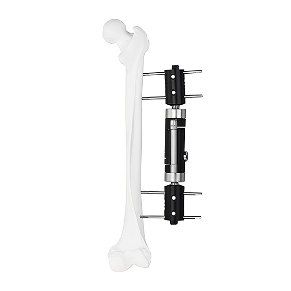 Динамический осевой внешний фиксатор