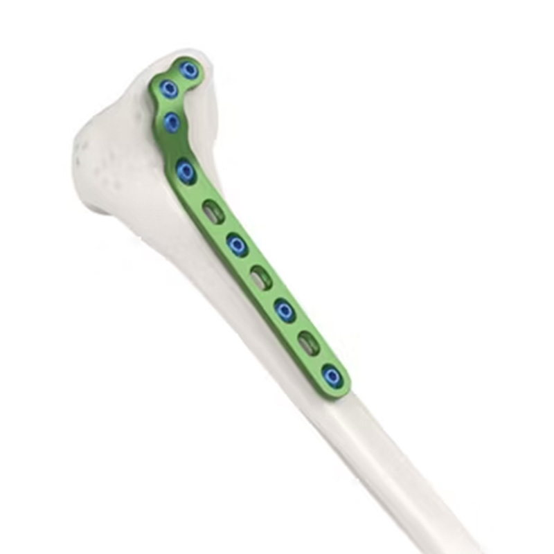 Неблокирующая пластина