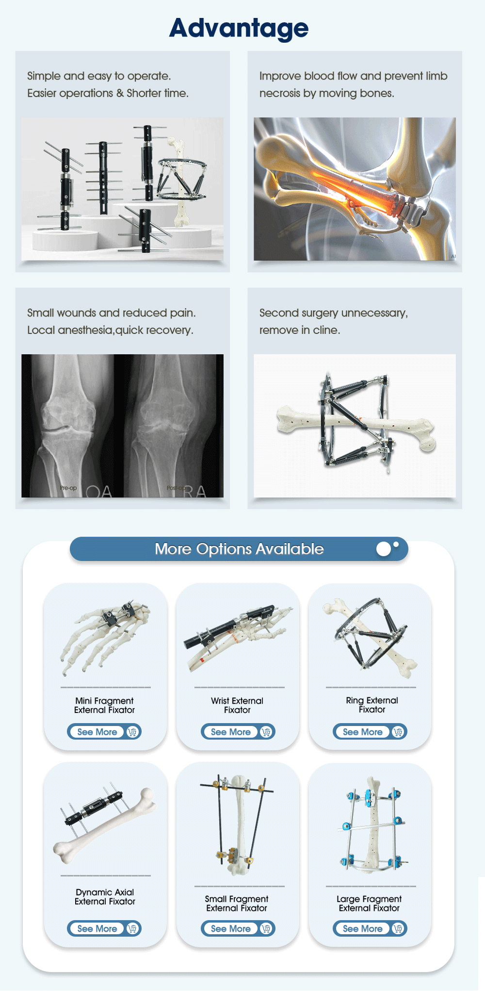  Внешний фиксатор для ноги — покупка продукта на XC Medico 