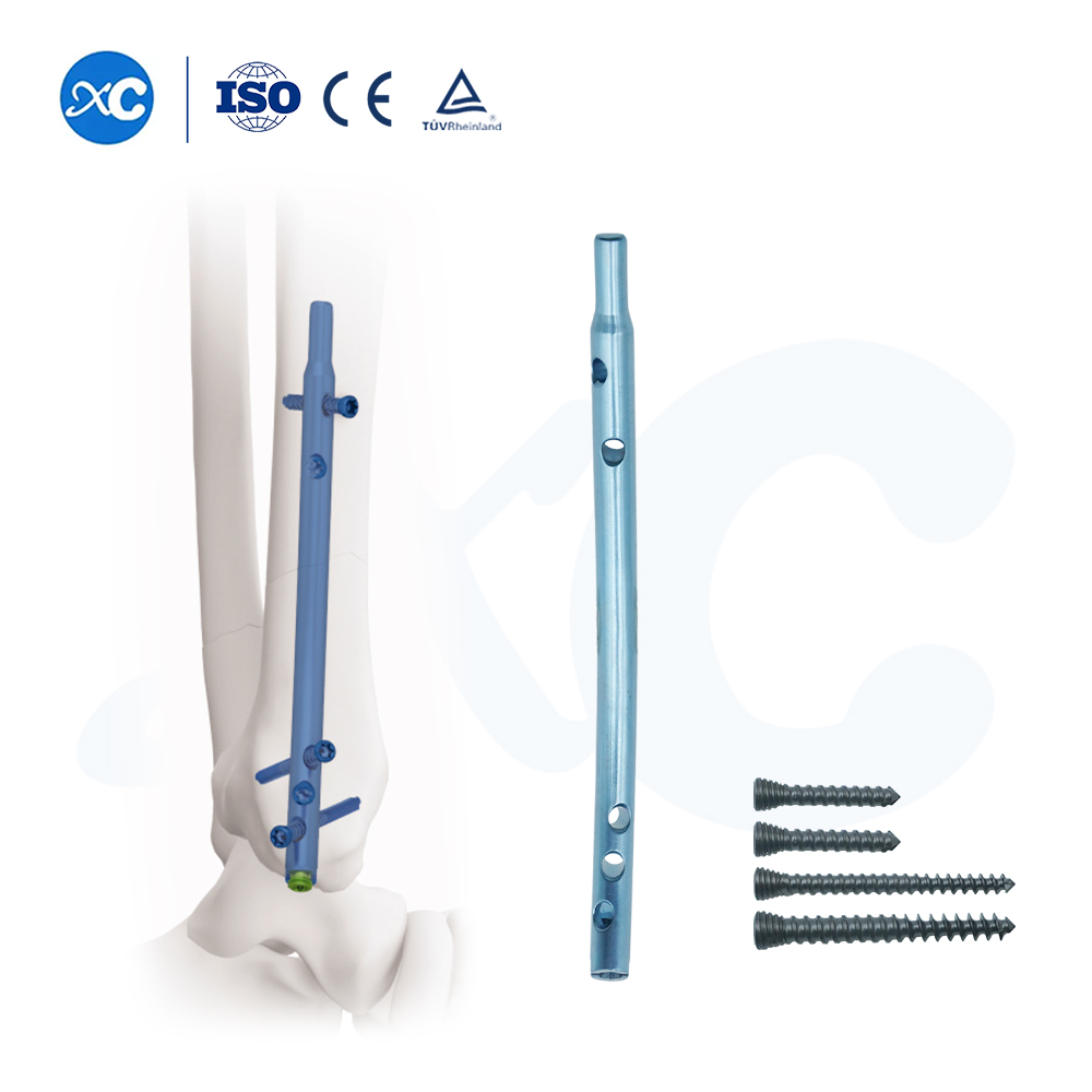 Дистальный большеберцовый интрамедуллярный стержень – ретроградная фиксация