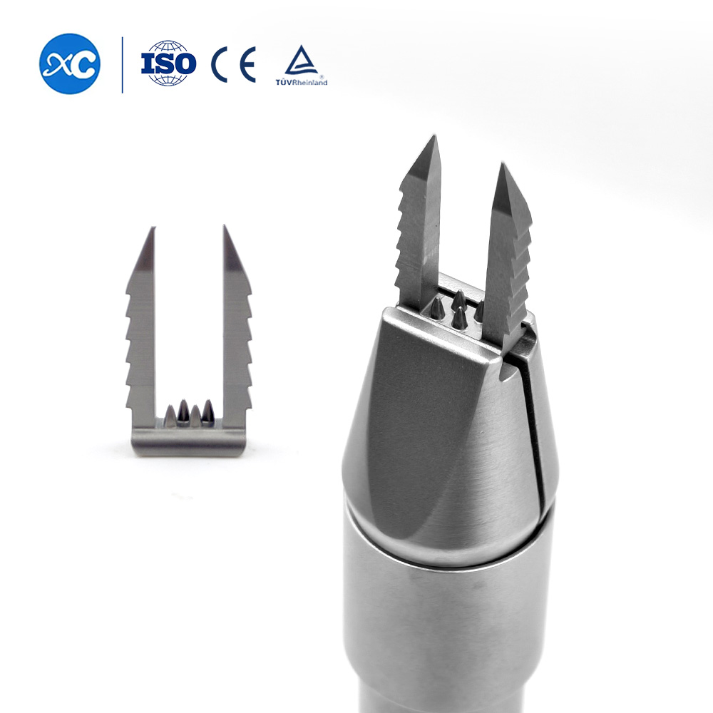 Степлерная система для фиксации связок – реконструкция передней крестообразной связки