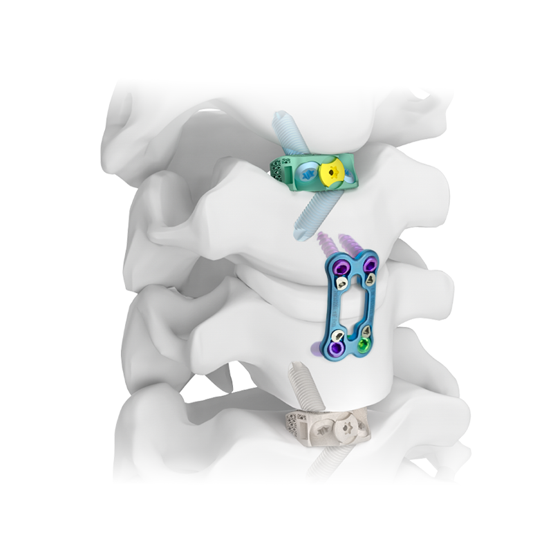 Обзор ортопедических заболеваний и заболеваний позвоночника