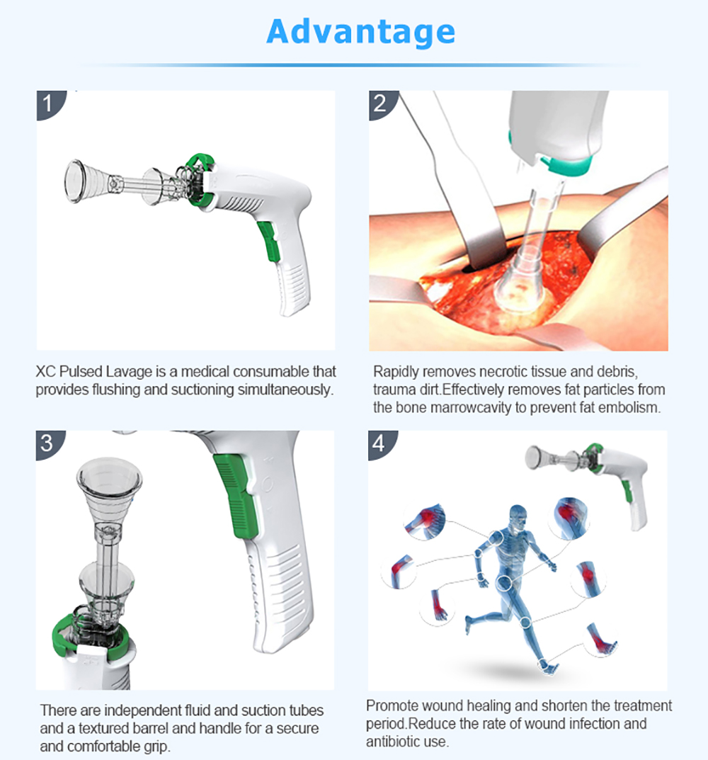  Медицинский импульсный лаваж - XC Medico