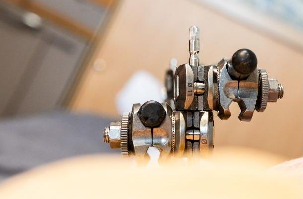 Баннер внешней фиксации-8