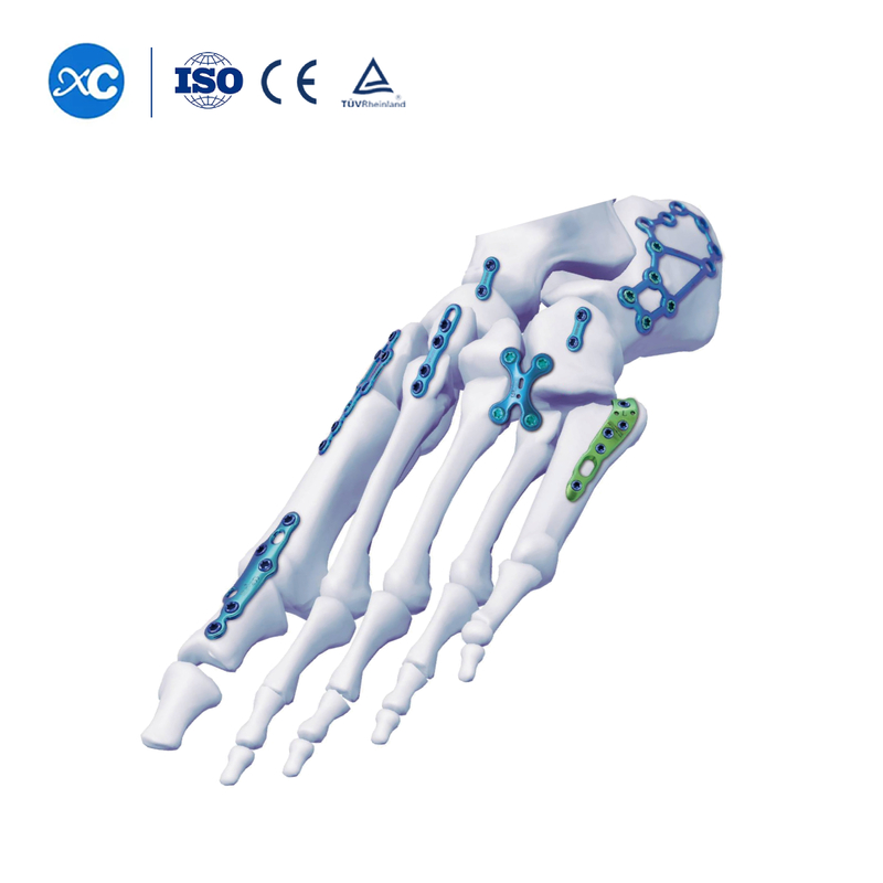 Система стопорных пластин для стопы и лодыжки
