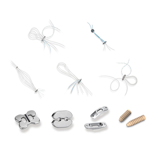 Система фиксации связок